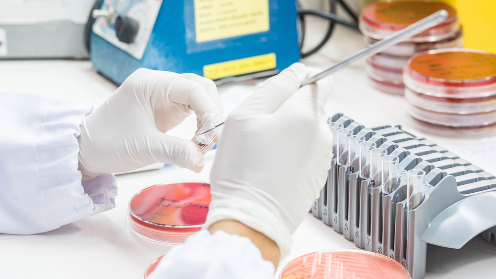 Close,Up,For,Hand,Medical,Technicians,Working,On,Culture,Bacteria